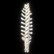 Spine