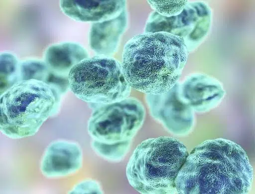 Tularemia
