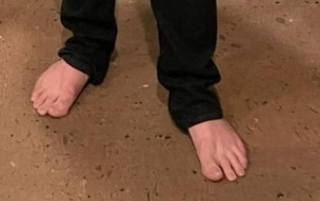 Toe