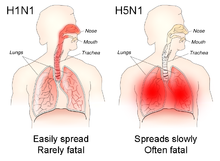 H5N1