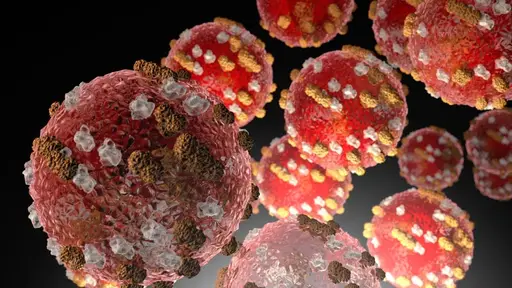 MEASLES