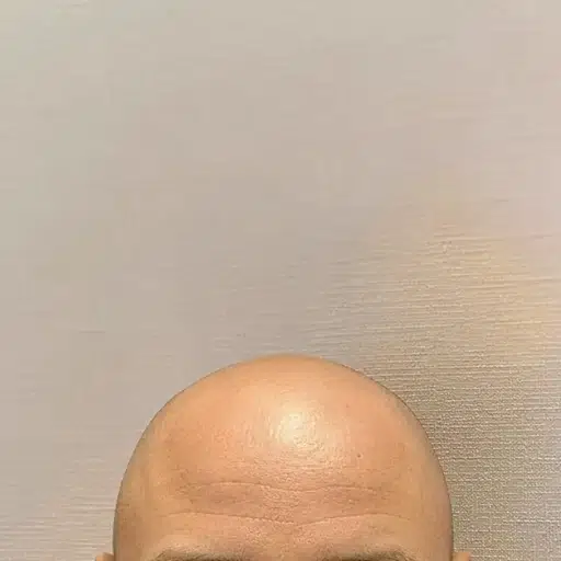 BALD