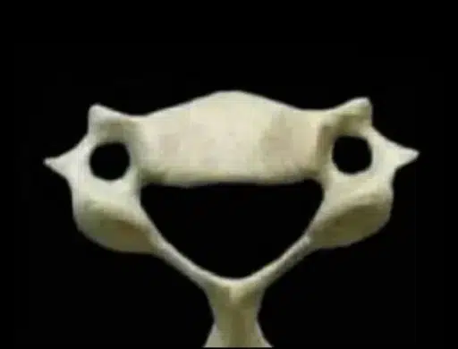 Vertebra