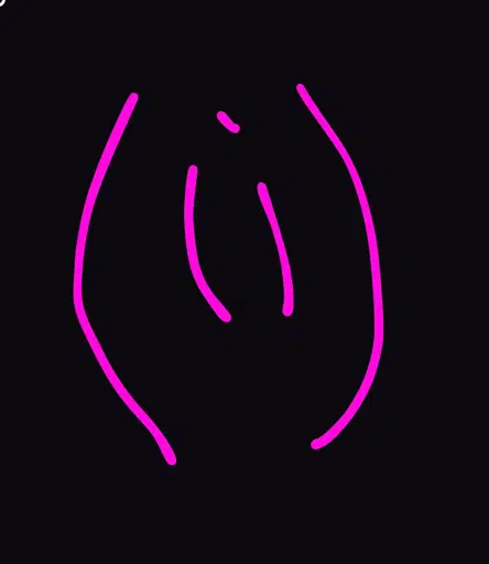 VAG