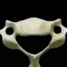 Vertebrae