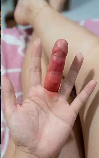 FIH