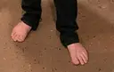 Toe