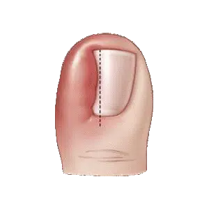 Toenail