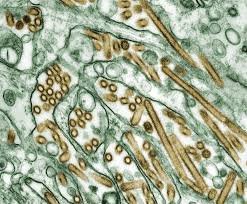 H5N1