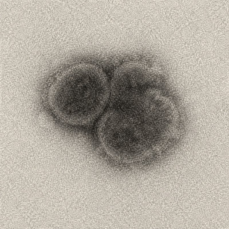 IP