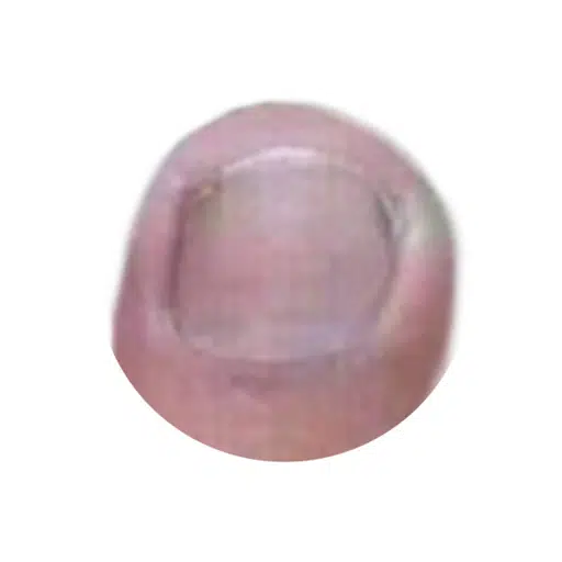 toeken