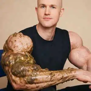Armshit