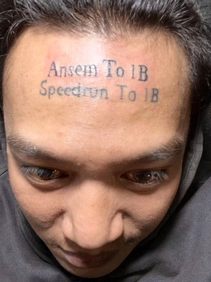 1B
